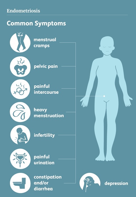 SYMPTOMS OF ENDOMETRIOSIS ​